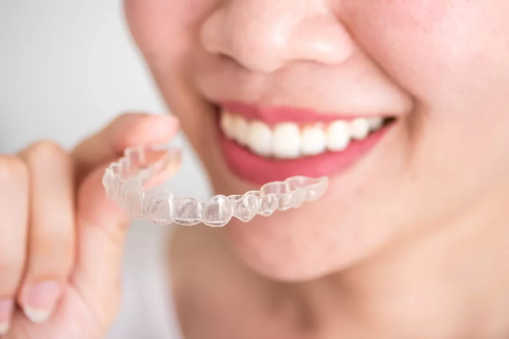 Şeffaf Plaklarla (İnvisalign) Çapraşıklık Tedavisi