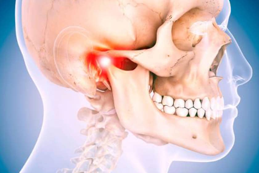 Çene Eklemi Hastalıkları Nasıl Fark Edilir? Semptomlar, Bruksizm–Otoimmün İlişki ve Magnezyum